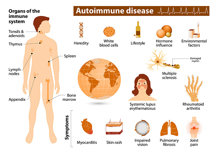 Auto Immune Diseases